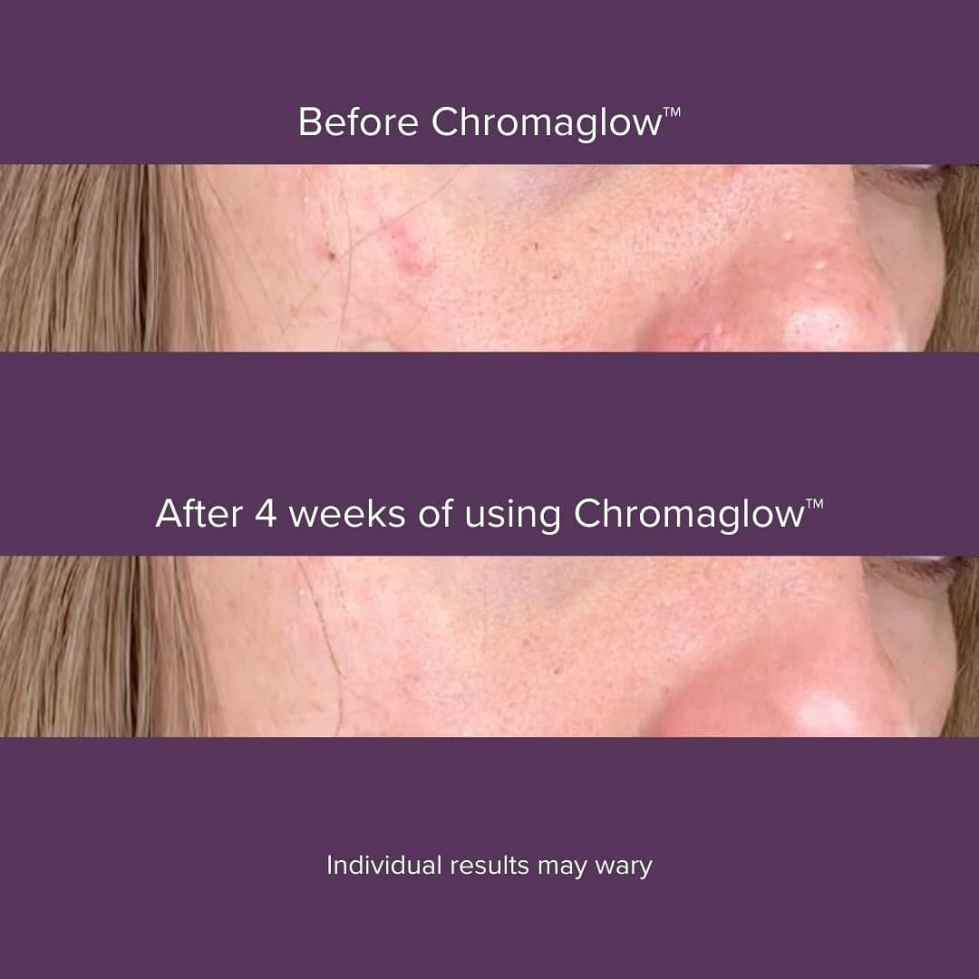 Chromaglow™ 7 Color Skincare Wand