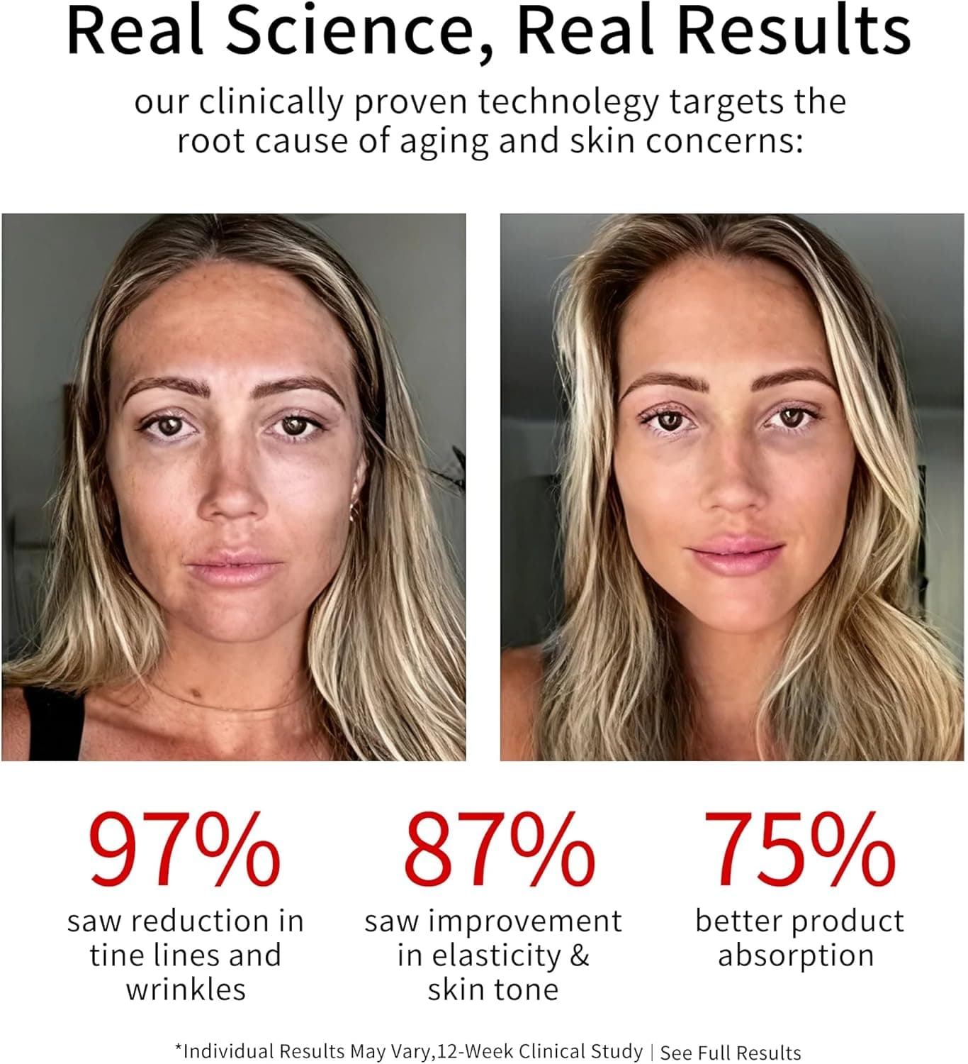 Era of Nature Face and Neck LED Massager – Warm & Vibrating Beauty Device, Waterproof & Rechargeable Relaxation Tool for a Smooth, Radiant, and Refreshed Appearance image