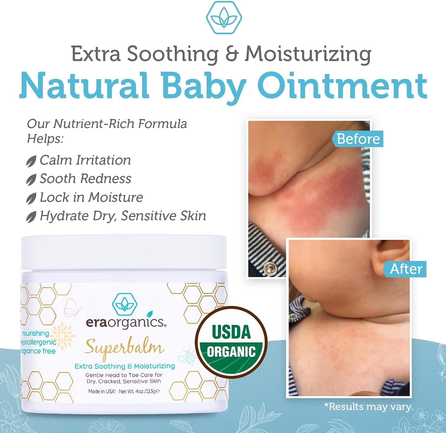 Era Organics Healing Ointment for Babies - USDA Certified Organic Natural Gentle Moisturizer for Sensitive Skin Prone To Baby Eczema, Cradle Cap (Infant Seborrheic Dermatitis), Rashes & Hives (4 oz.) Super Balm 4 Ounce (Pack of 1)