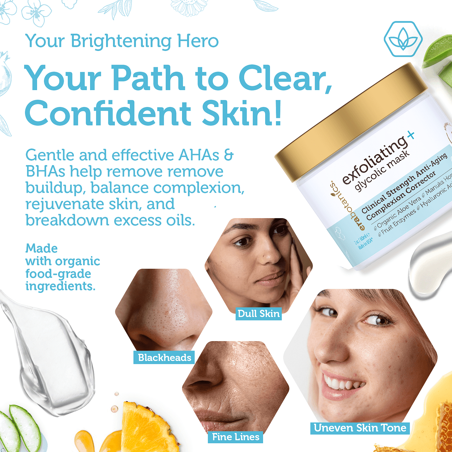 Glycolic acid chemical peel