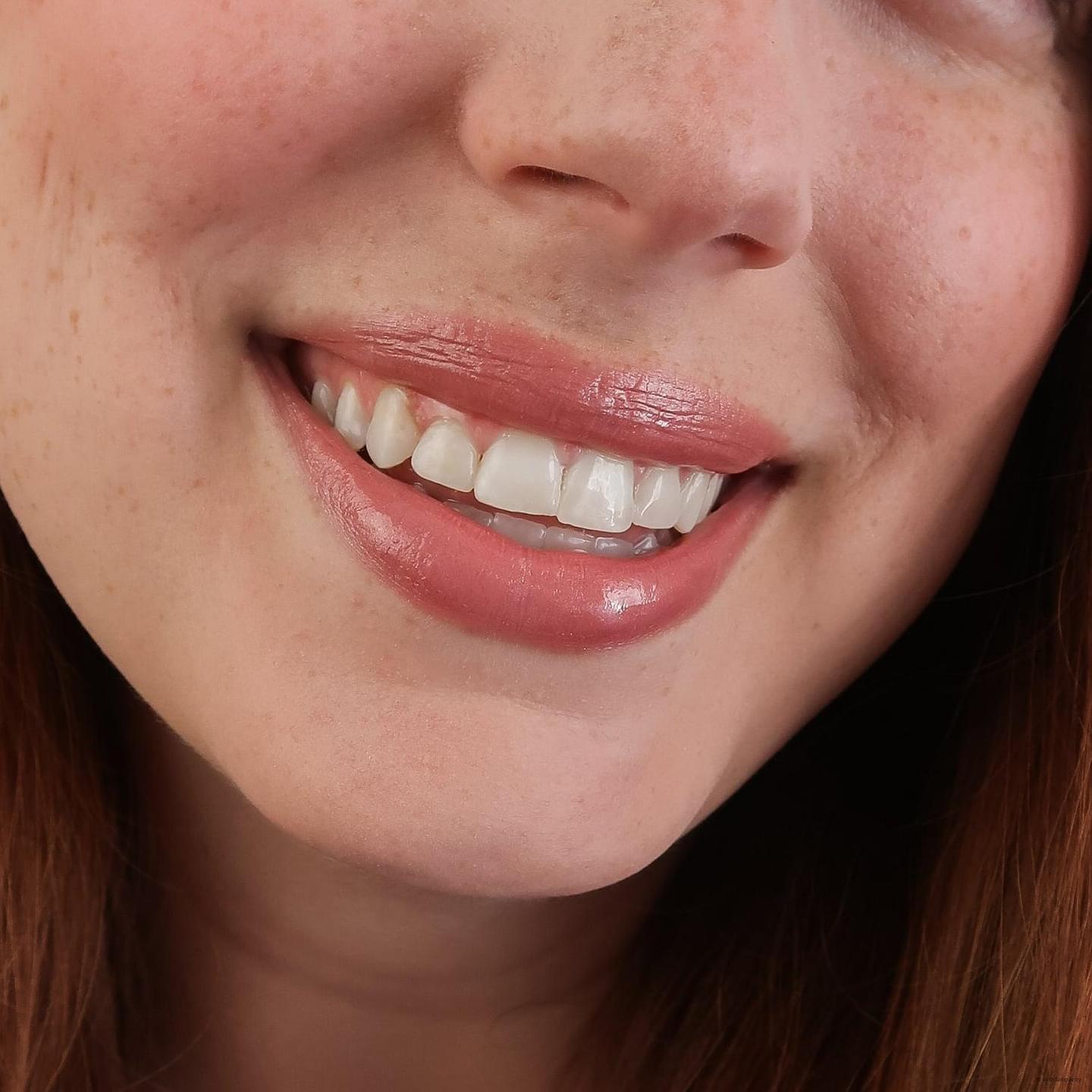Lip Gloss