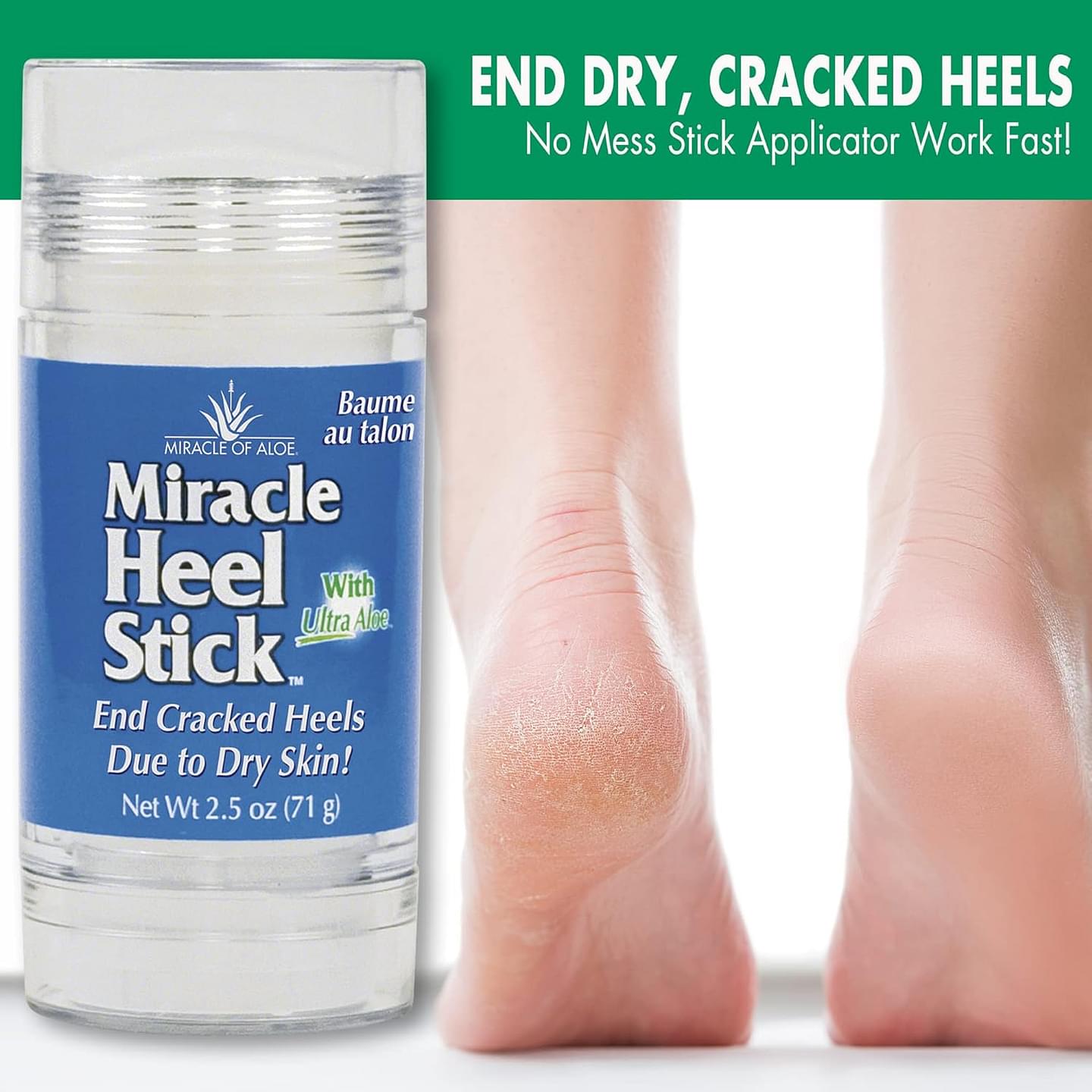 Miracle Heel Stick with Pure UltraAloe Aloe Vera Gel | 2.5 ounce stick 2.5 Ounce (Pack of 1)