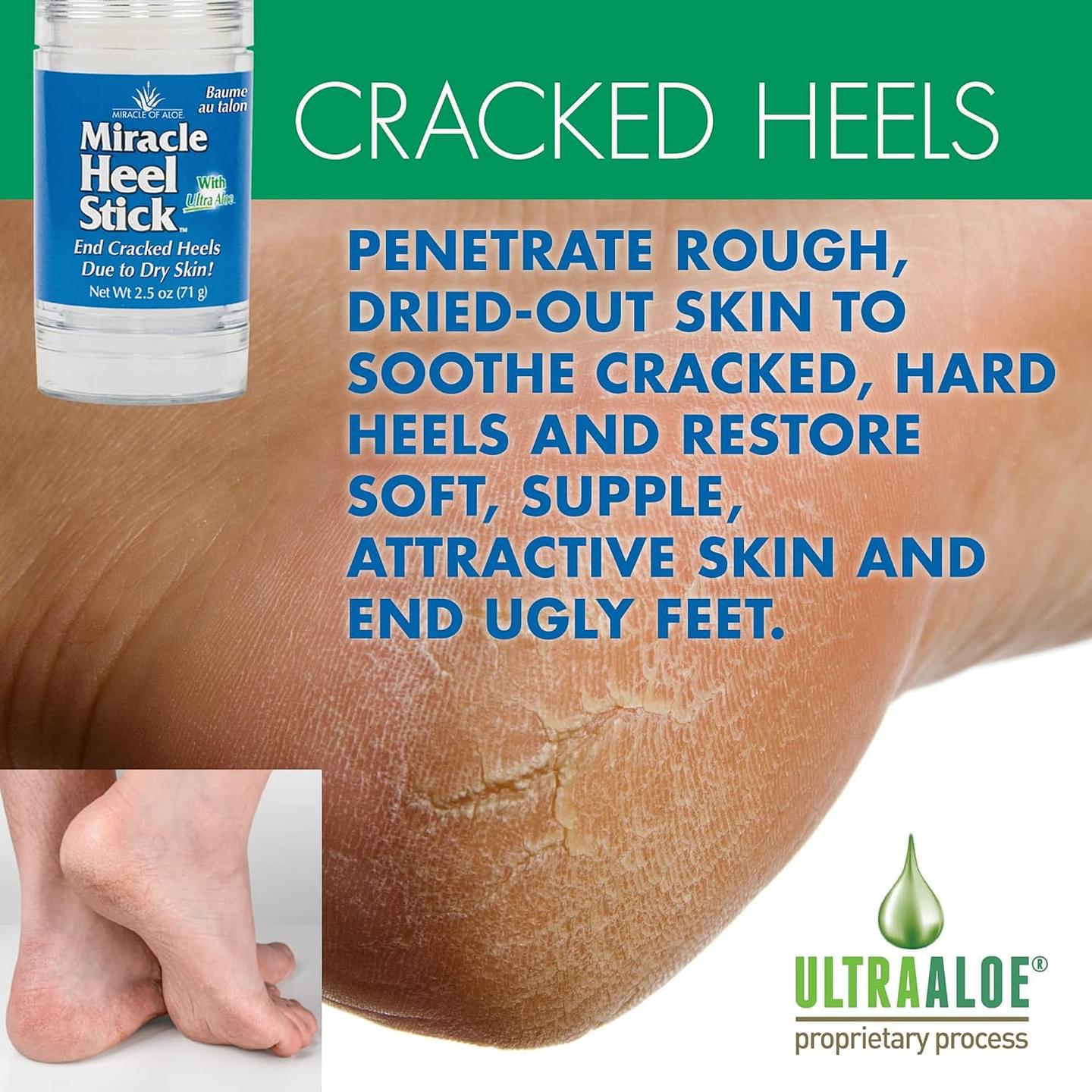 Miracle of Aloe, Miracle Heel Stick - Gel Socks Combo with UltraAloe, 2.5 ounce Stick and Silicone Moisturizing Gel Heel Socks Heel Stick and Heel Socks