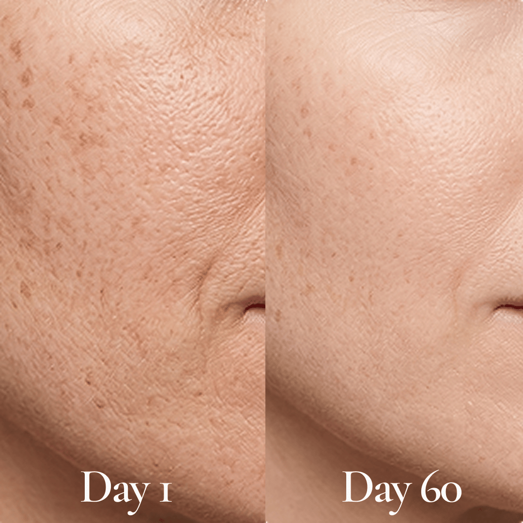 The Evening Glow + Texture Fix - Complete Four-Piece Overnight Skincare Routine