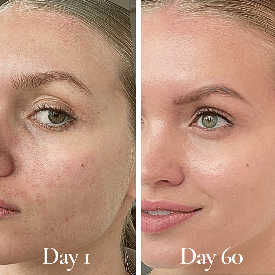 The Morning Glow + Texture Fix - Complete Four-Piece AM Skincare Routine