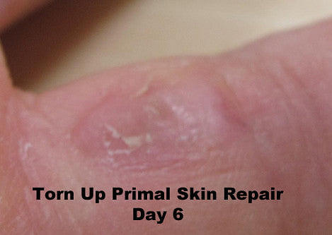 Torn Up Skin Repair