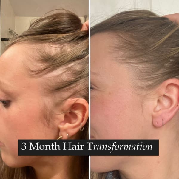 3 Month Hair Transformation (1)