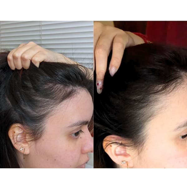 Evatasha Hair Growth