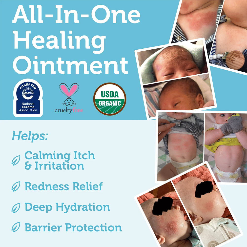 Healing Ointment Baby Eczema Cream 5