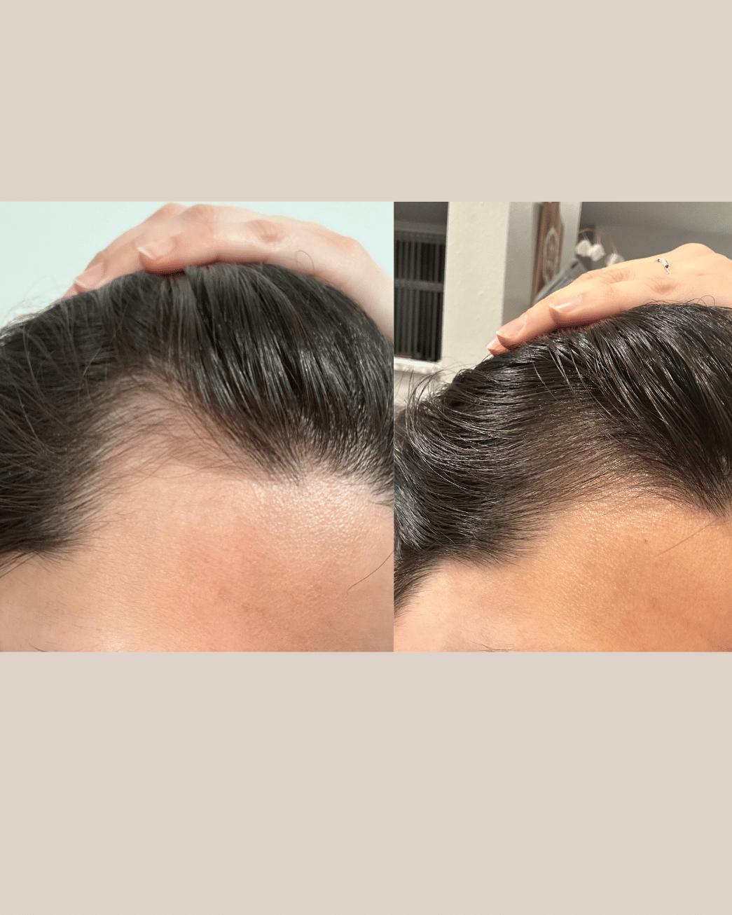 Evatasha Beauty Restore Hair Tonic
