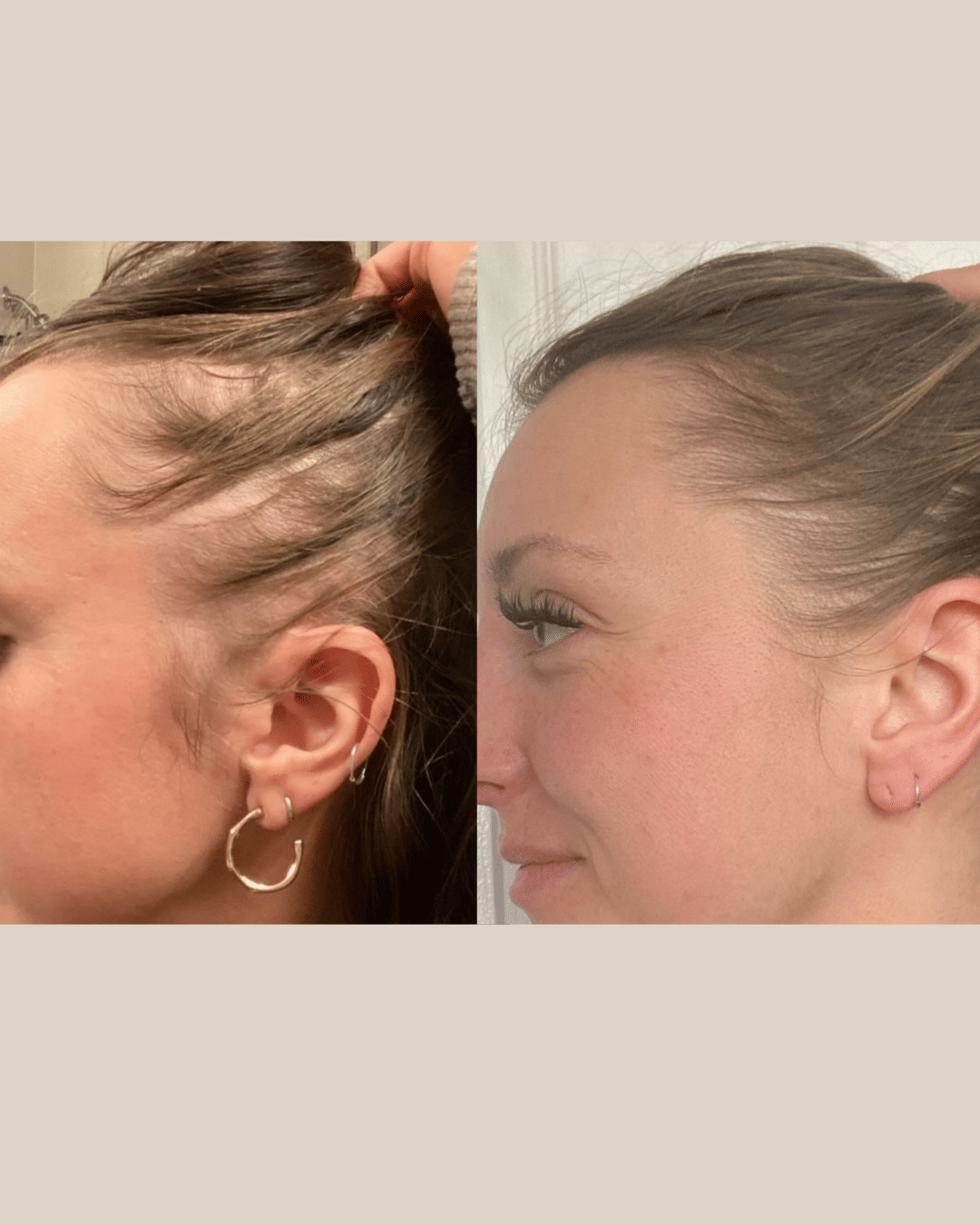 Evatasha Beauty Repair Hair Oil Before & After