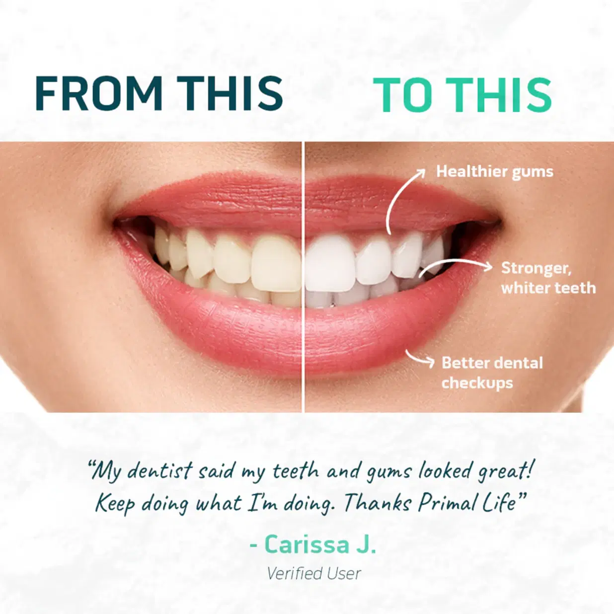 Dental Detox Kit - Prevents Cavities & Gum Disease - Natural Ingredients - Certified Organic