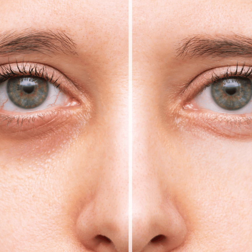 Concealer | versatile, lightweight - dark_circles